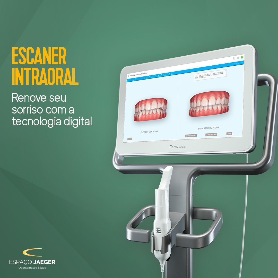 Tratamento Invisalign com Escaner Intraoral – Renove seu sorriso com a ortodontia digital