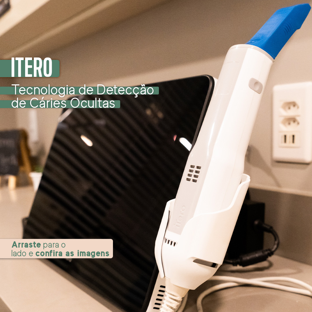 Itero: Scanner de detecção da Cárie Oculta