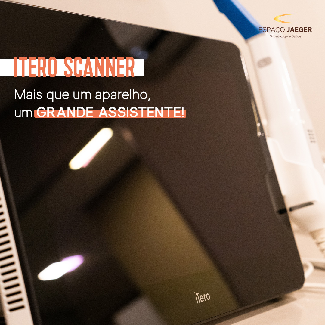 Itero Scanner – Mais que um aparelho, um grande assistente!